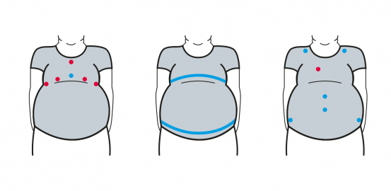 ObeSense: an “intelligent” T-shirt to fight obesity